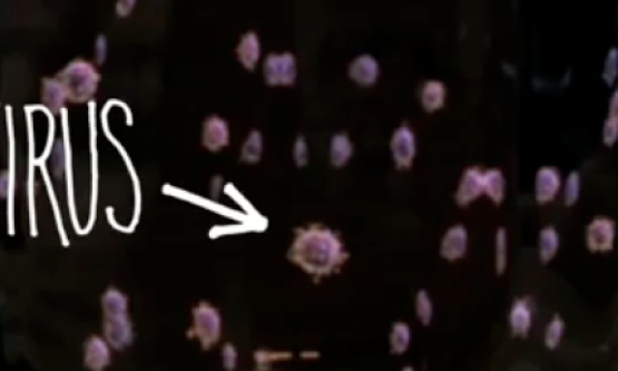 influenza